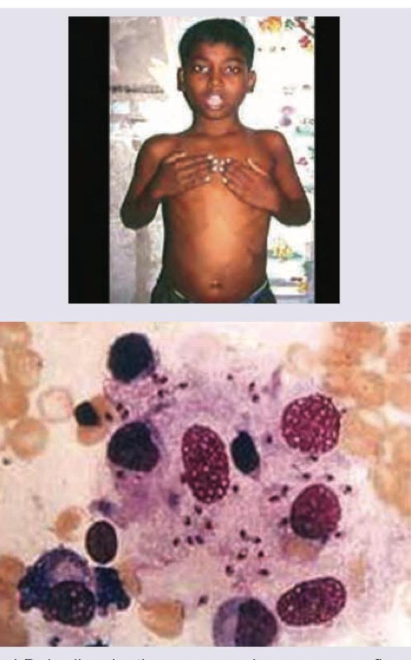 Image for question 175