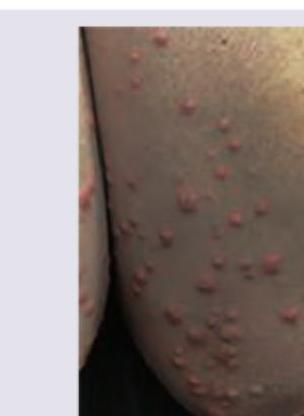 Image for question 75