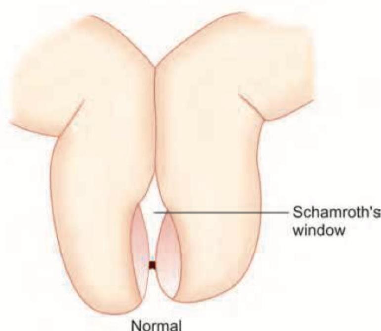 Image for question 66