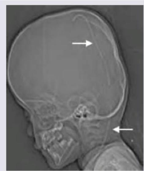 Image for question 752