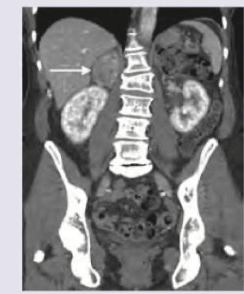 Image for question 1315