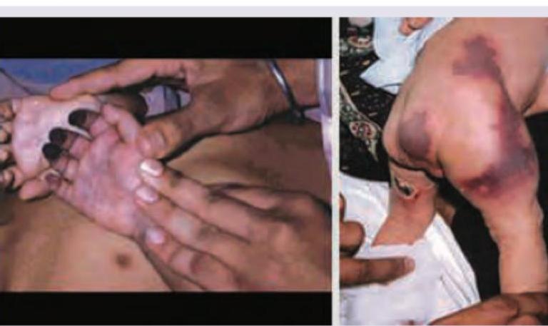 Image for question 168