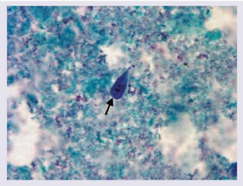 Image for question 781