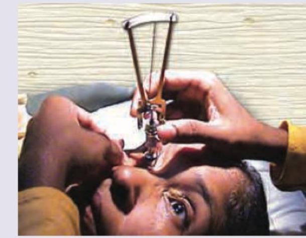 Image for question 330