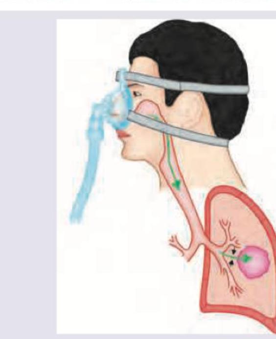 Image for question 286