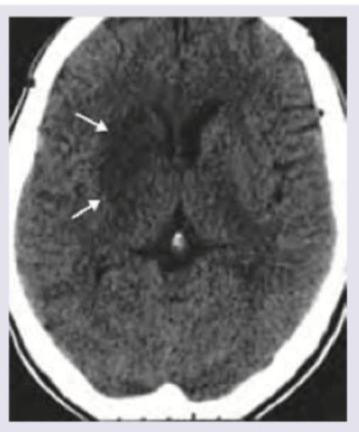 Image for question 16