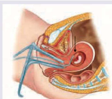 Image for question 941