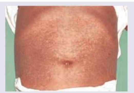 Image for question 249