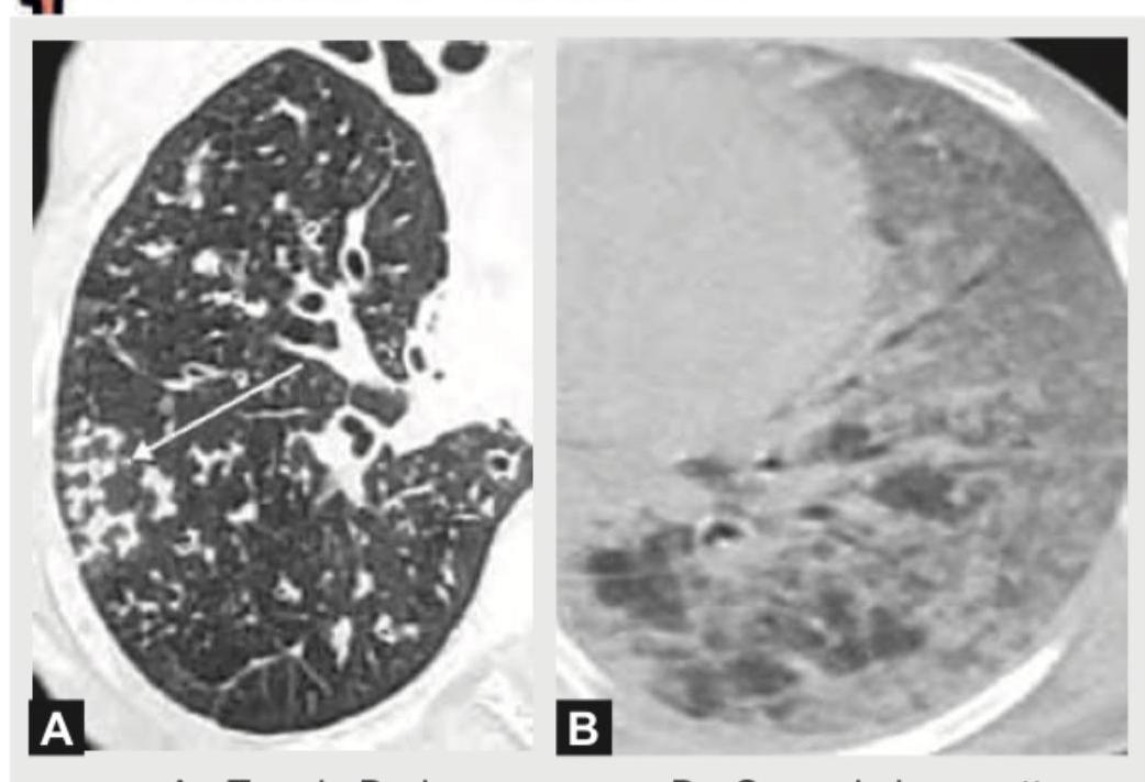 Image for question 396