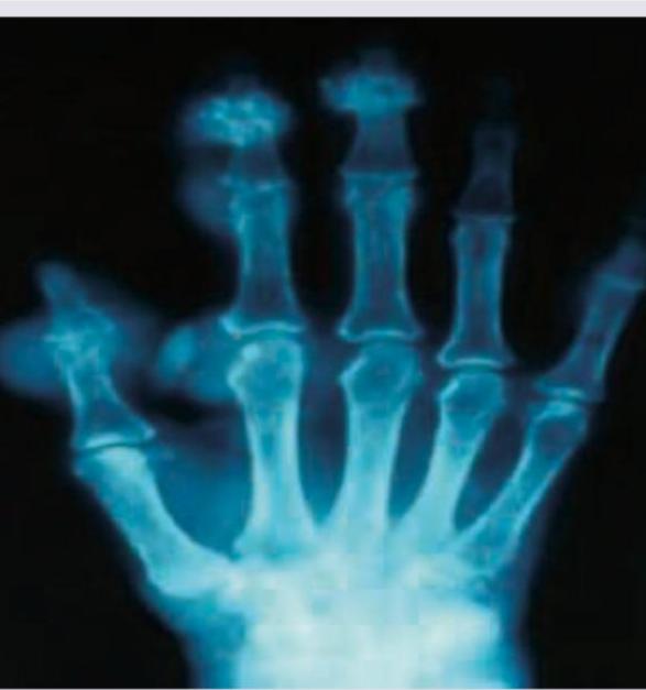 Image for question 618