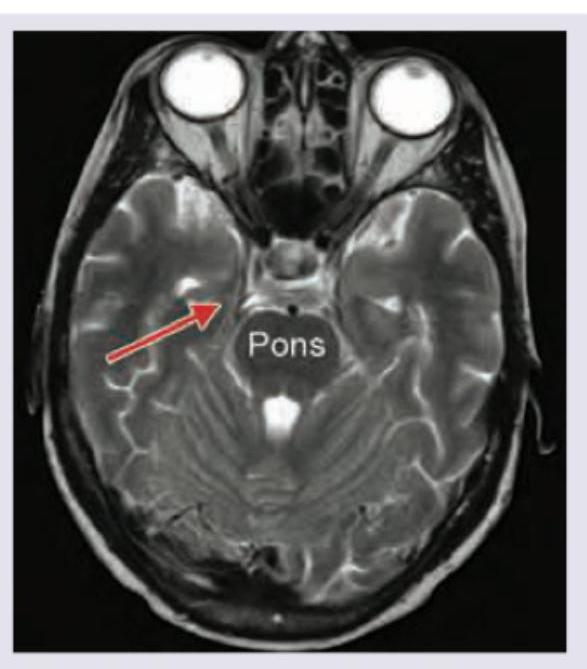 Image for question 366