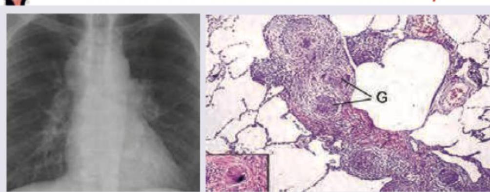 Image for question 174