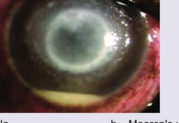 Image for question 318