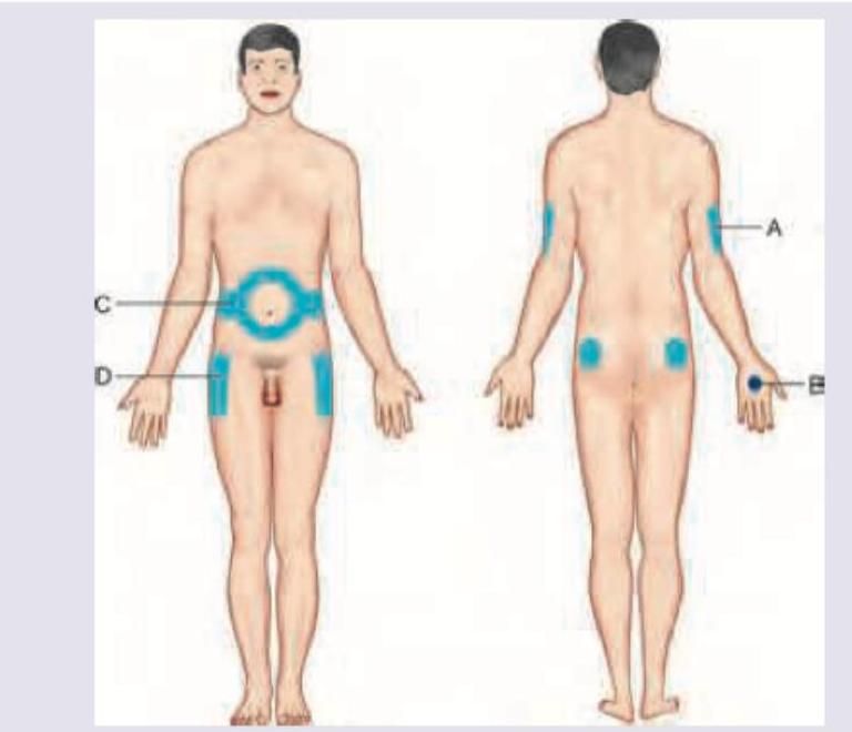 Image for question 177