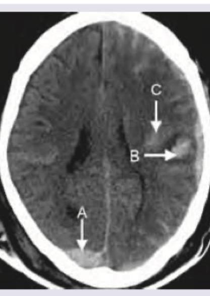 Image for question 344