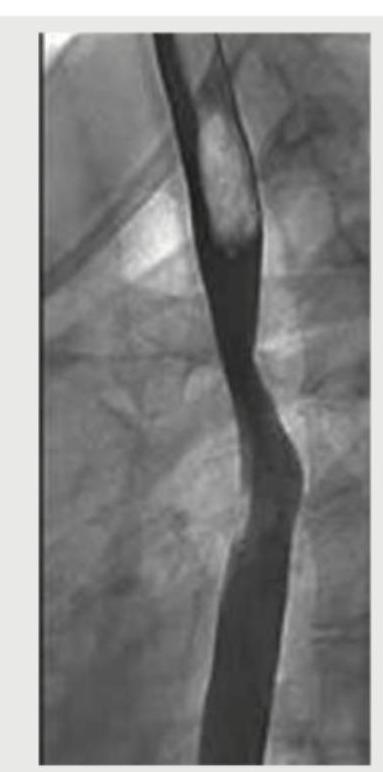 Image for question 173