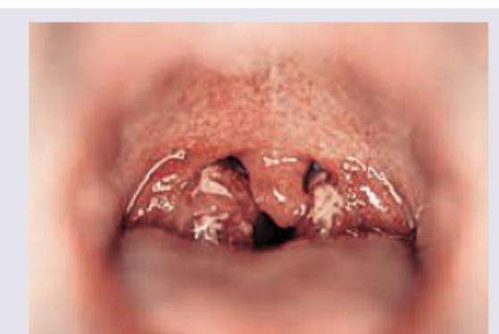 Image for question 253