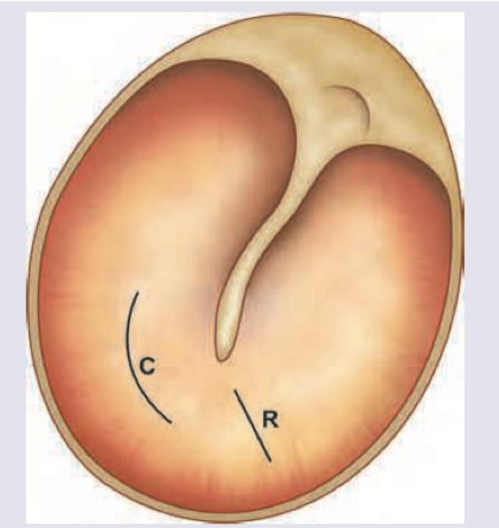 Image for question 190