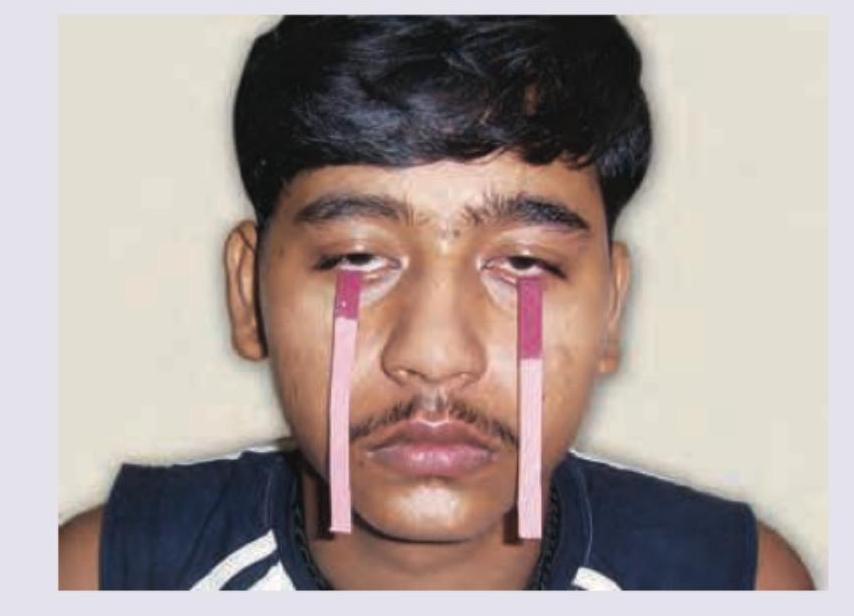 Image for question 194