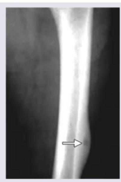 Image for question 245