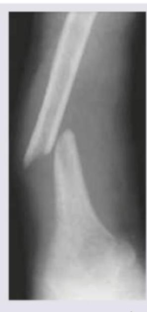 Image for question 906