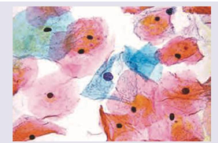 Image for question 118