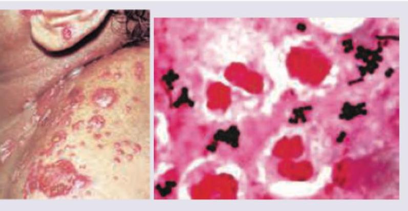 Image for question 168