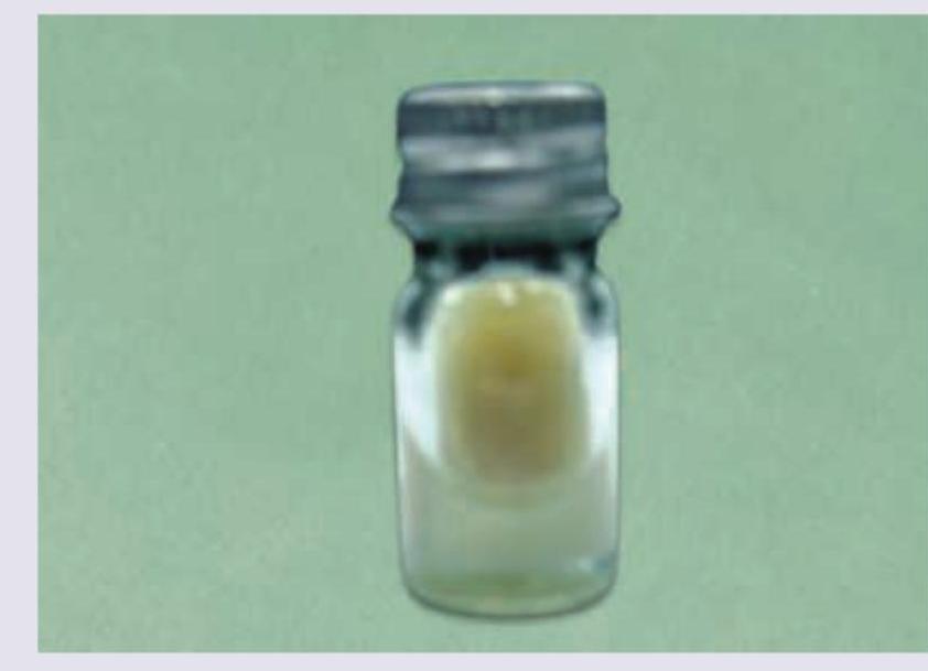 Image for question 174