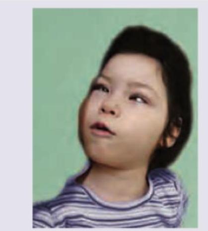 Image for question 650