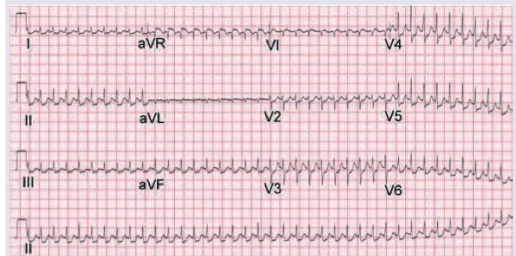 Image for question 110