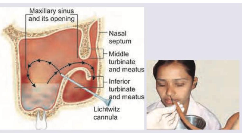 Image for question 334