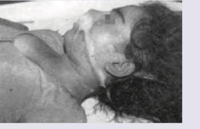 Image for question 216