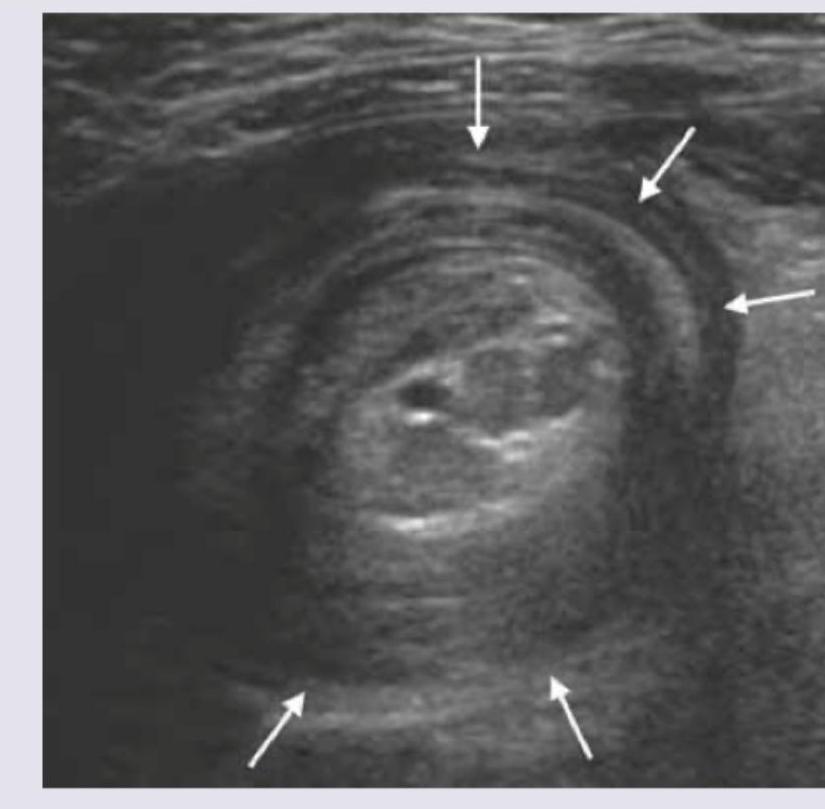 Image for question 164