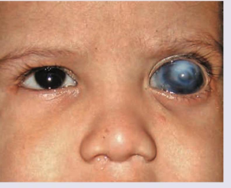 Image for question 333