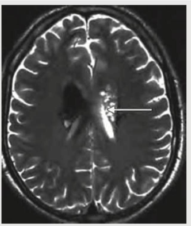 Image for question 356