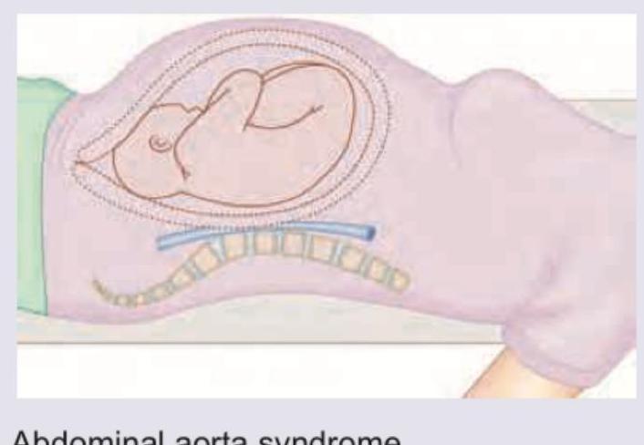 Image for question 946