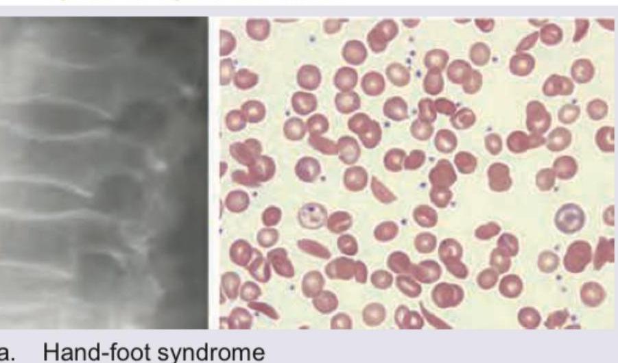 Image for question 171