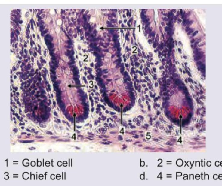 Image for question 387