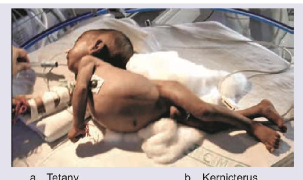 Image for question 202