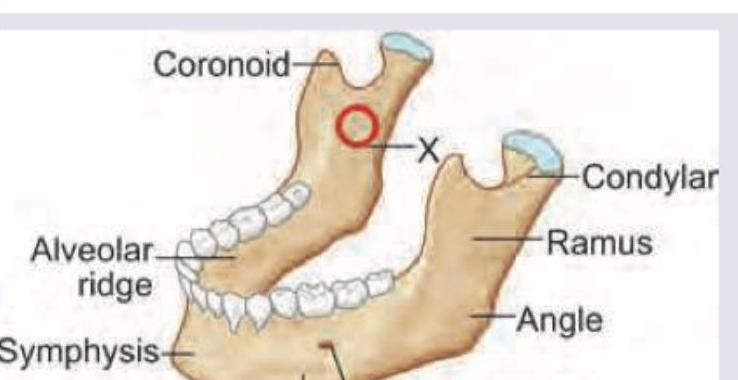 Image for question 39