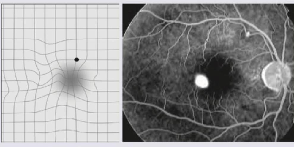 Image for question 458