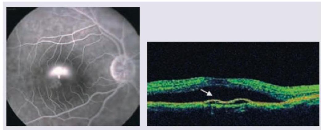 Image for question 465