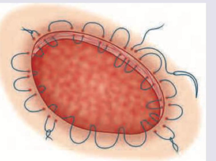 Image for question 786