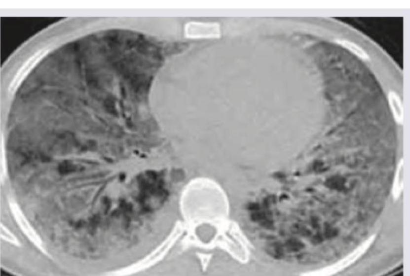 Image for question 377