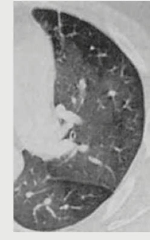 Image for question 391