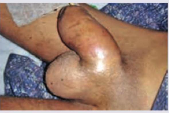 Image for question 700