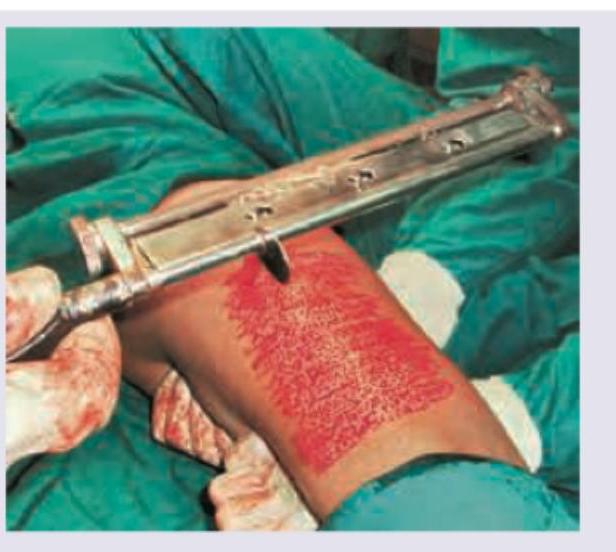 Image for question 167