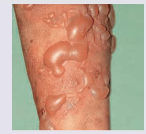 Image for question 152