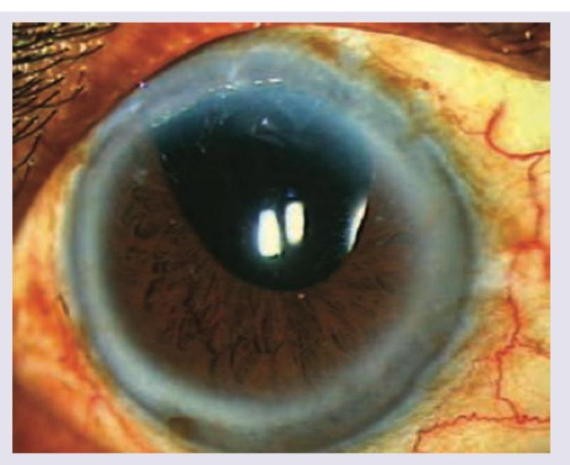 Image for question 90