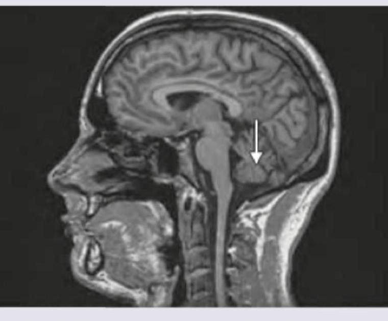 Image for question 369